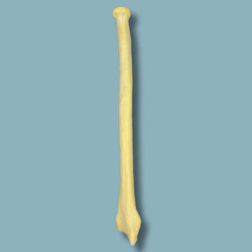 Anatomisches Modell / Radius - 13-02-01 - ADDIDREAM - Chirurgie / Ausbildung / Traumazustände