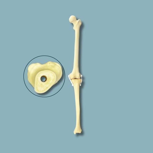 Anatomisches Modell / Knie - 04-04-03 - ADDIDREAM - Chirurgie / Ausbildung / Schaumstoff