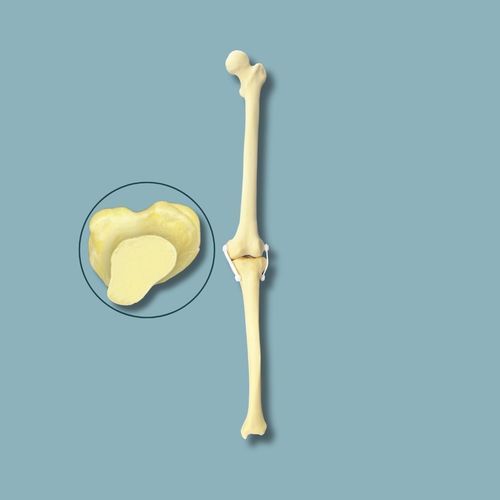 Anatomisches Modell / Knie - 04-01-03 - ADDIDREAM - Chirurgie / Ausbildung / Schaumstoff