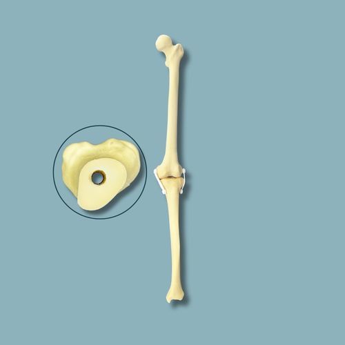 Anatomisches Modell / Knie - 04-31-02 - ADDIDREAM - Knochen / Chirurgie / Ausbildung