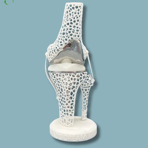 Anatomisches Modell / Knie - 04-AJ-01 - ADDIDREAM - Tibia / Oberschenkelknochen / für Vorführzwecke