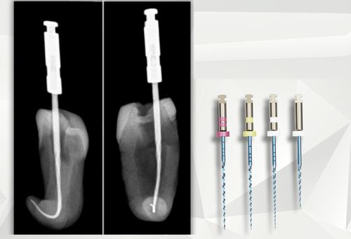 Rotations-Zahnfeile - croot0003 - C-Root Dental Medical - für Wurzelkanal-Behandlungen / NiTi