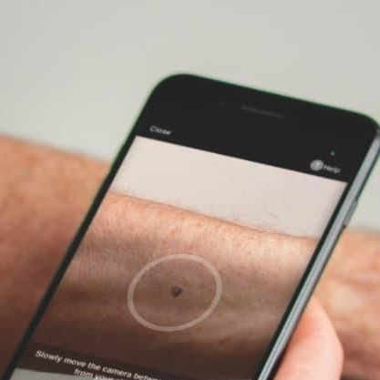 Web-Anwendung / für die Hautdiagnose - SkinVision - Skinvision - Dermatologie / Android / iOS