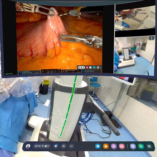 4K-OPVideoSystem - mSurgery - mSurgery - MP4 / MPEG / AVI