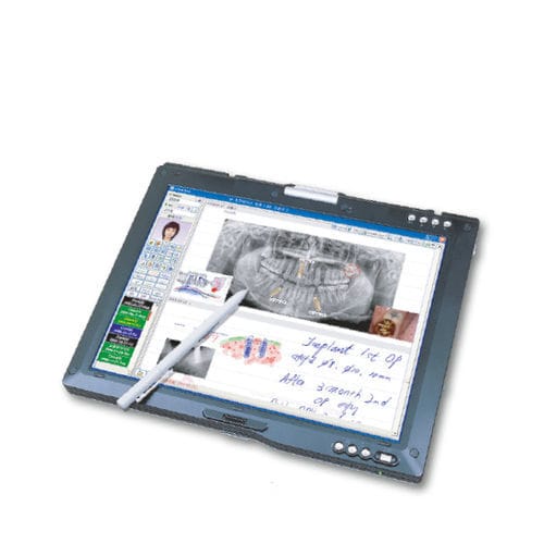 Analysesoftware - O.K  - Point Implant - Management / Umform / Simulation