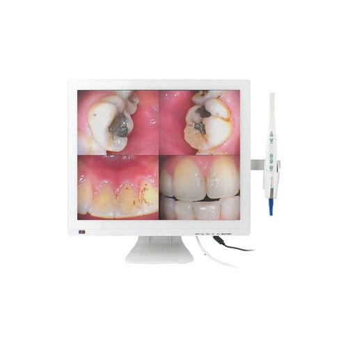 Intraorale Kamera - M-978V - Chuan Fu Medical Instrument Co., Ltd. - digital / CMOS