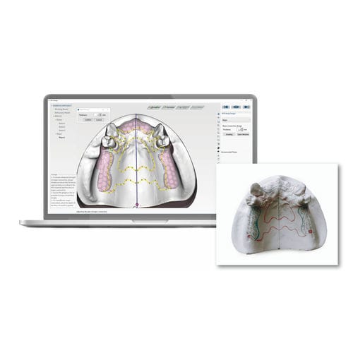 Medizinische Software - iPD - Profeta 3D - Dental / Projektentwicklung / Erfassung