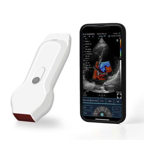Ultraschall-Handgerät - YSB-C10XL - YSENMED - für Kardiologie / für Brust-Ultraschall / für kutane Ultraschalluntersuchung