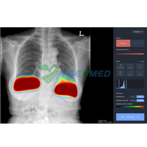 Medizinische Software - YSX-AI-C - YSENMED - für medizinische Bildgebung / für Radiologie / für Kliniken