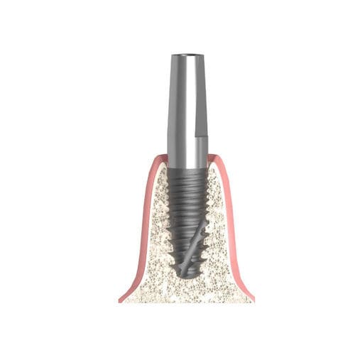 Implantat-Abutment / Konus zylindrisch - Actival - Bionika Medline Kft. - Titan / mit Innenverbindung / gerade