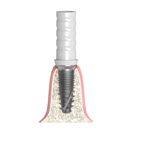 Implantat-Abutment / Kunststoff - Actival - Bionika Medline Kft. - Konus zylindrisch / CoCr / mit Innenverbindung