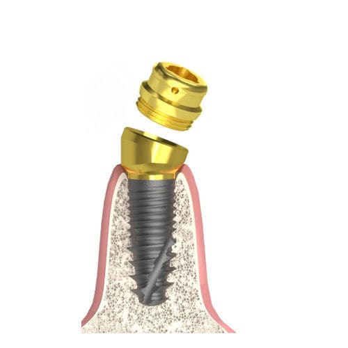 Implantat-Abutment / Konus zylindrisch - Actival - Bionika Medline Kft. - konisch / mit Innenverbindung / Schrauben