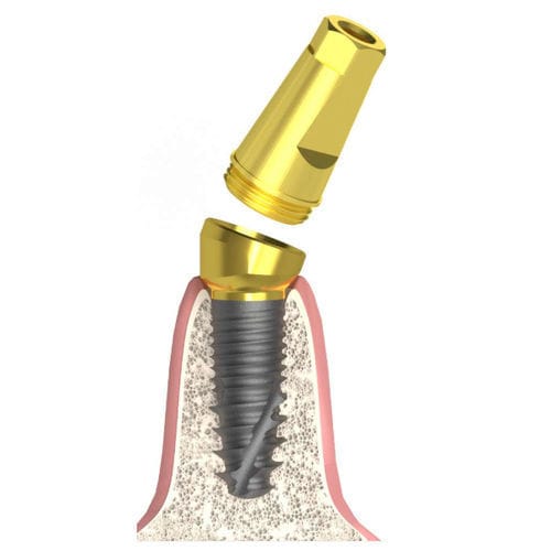 Konisches Implantat-Abutment - Actival - Bionika Medline Kft. - konisch / mit Innenverbindung / Schrauben