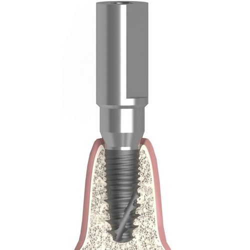 Intraoraler Scankörper - UNIFORM SIC® ace® max® - Bionika Medline Kft. - Metall