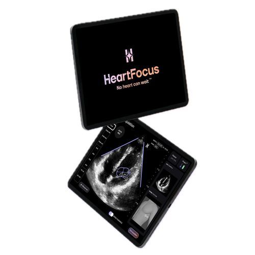 Mobile Applikation / für Echokardiographie - HeartFocus - DESKI - Diagnose / Reporting / Monitoring