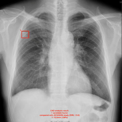 Software / künstliche Intelligenz - EIRL - LPIXEL Inc. - Visualisierung / Diagnose / Bildanalyse