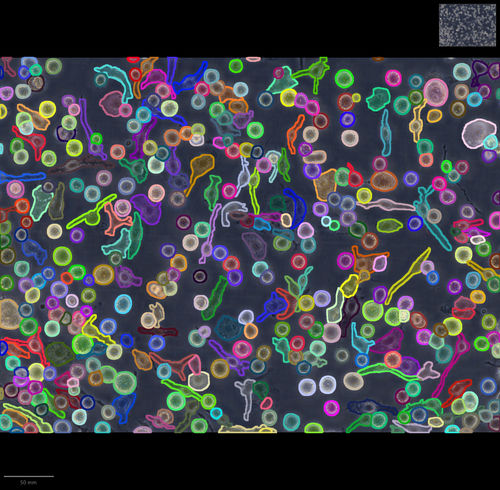 Software / künstliche Intelligenz - IMACEL - LPIXEL Inc. - Bildanalyse / für zellulare Bildgebung / Makroskopische Bildgebung der Erkrankung