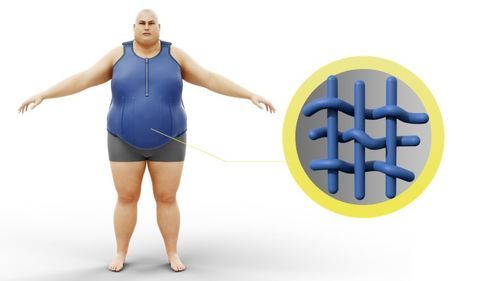 Bauchstütze für Erwachsene - NOVAVITA - NOVATEX MEDICAL - für Übergewichtige / mit Riemen / einstellbar