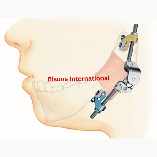 Kieferchirurgischer Distraktor - BI-001477 - Bisons International - Schädel / außen / für Erwachsene