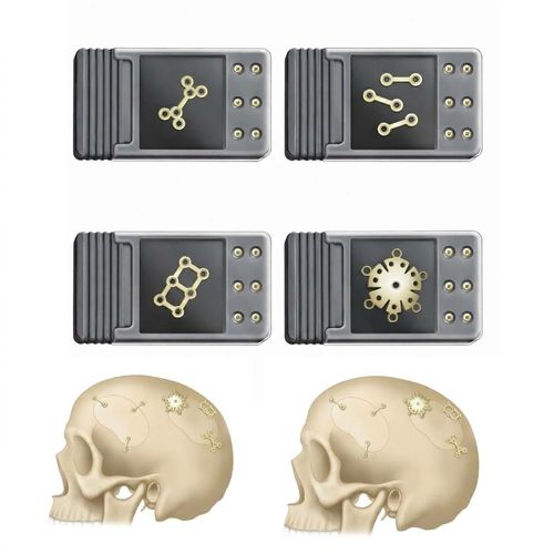 Gesicht Implantat, ästhetisch - BI-002183 - Bisons International - anatomisch / Aus Kobalt-Chrom