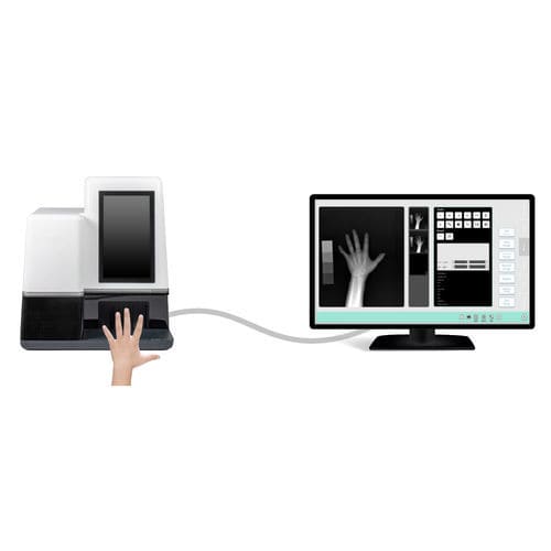 Digitales Röntgensystem - MedAlliance Inc. - für Gelenkröntgen / für pädiatrische Röntgenaufnahmen