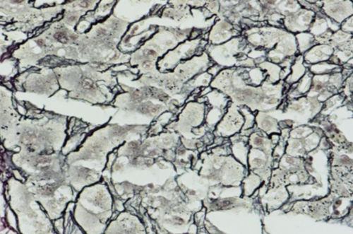 Farbstoff Reagenzkit - Wuhan Jinhong Biotech Development Co., Ltd. - für die Histologie