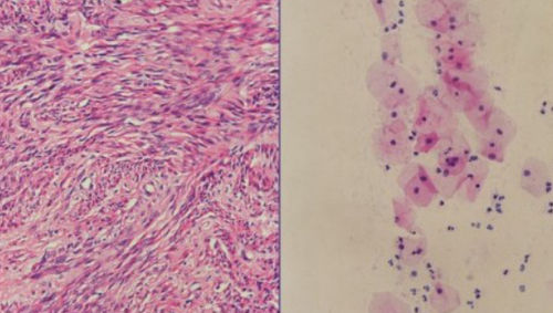 Reagenzkit / Hämatoxylin nach Harris - H-E stain - Wuhan Jinhong Biotech Development Co., Ltd. - für die Histopathologie