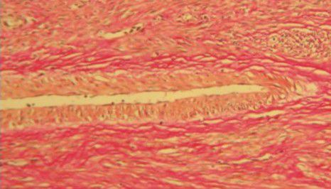 Farbstoff Reagenzkit - BA4084A - Wuhan Jinhong Biotech Development Co., Ltd. - für die Histopathologie