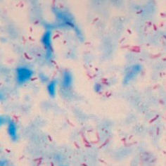 Farbstoff Reagenzkit - BA4090 - Wuhan Jinhong Biotech Development Co., Ltd. - für Mikrobiologie / Mycobacterium tuberculosis