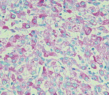 Farbstoff Reagenzkit - PAS Hepatin  - Wuhan Jinhong Biotech Development Co., Ltd. - Gewebe