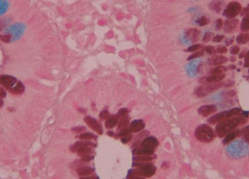 Farbstoff Reagenz - BA4120A - Wuhan Jinhong Biotech Development Co., Ltd. - für die Histologie