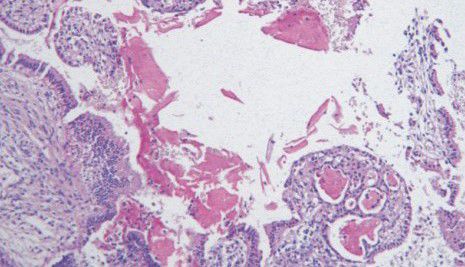 Farbstoff Reagenzkit - BA4086A - Wuhan Jinhong Biotech Development Co., Ltd. - für die Histologie / Cryptococcus neoformans
