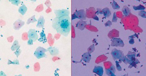 Farbstoff Reagenzkit - Papanicolaou Stain - Wuhan Jinhong Biotech Development Co., Ltd. - für Zytologie / für Kliniken