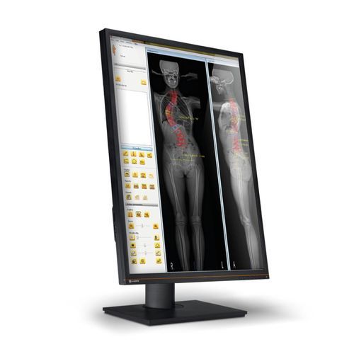 Modellierungssoftware - EOS IMAGING - Umform / Planung / medizinisch