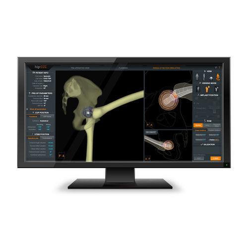 Medizinische Software - EOSapps - EOS IMAGING - Anatomie / für Radiologie / OP