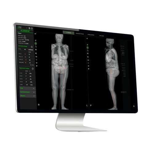 Medizinische KI-Plattform - EOS IMAGING - für medizinische Bildgebung / Quantifizierung / für maschinelles Lernen