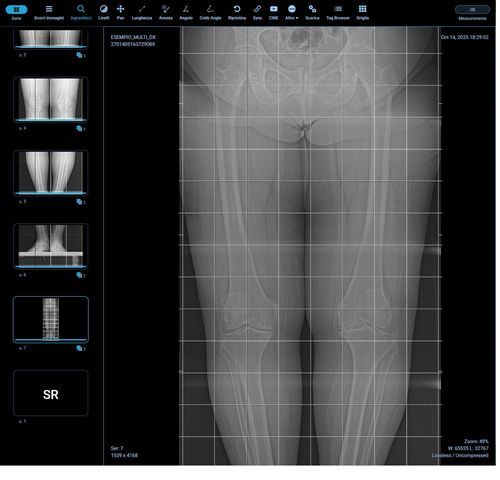 Software-Modul / für Radiologie - Orthogrid - G-Squared - Bildanalyse / Mess / Körper