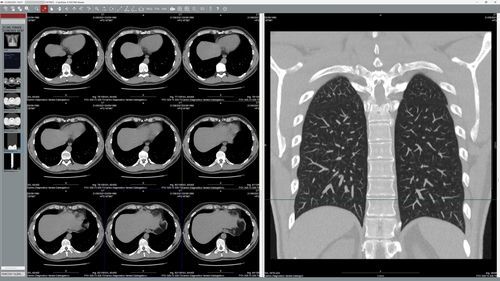 DICOM-Visualisierung-Software - EyeLite - G-Squared - medizinisch / für Telekonsultationen / Windows