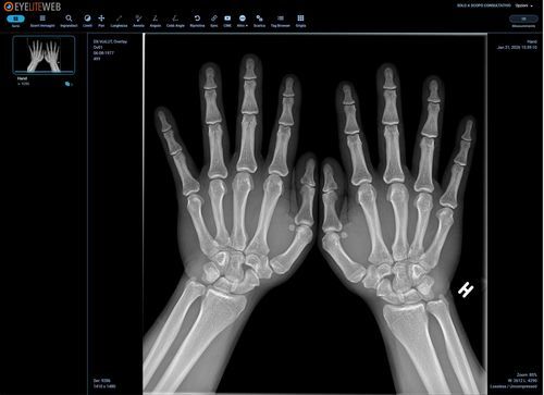Software-Modul / DICOM-Visualisierung - G-Squared