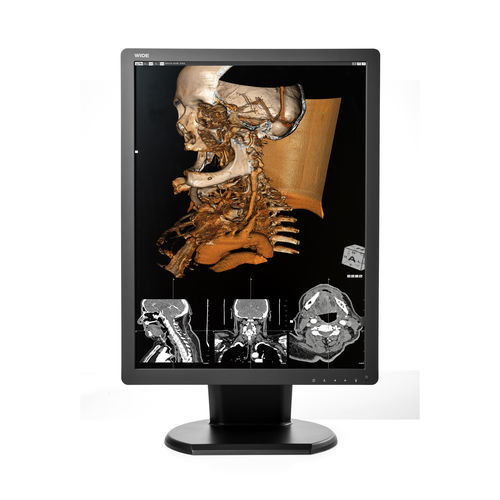 Diagnose-Monitor - CX30N - Wide USA Corporation - für medizinische Bildgebung / 2048 x 1536 / 21,3"