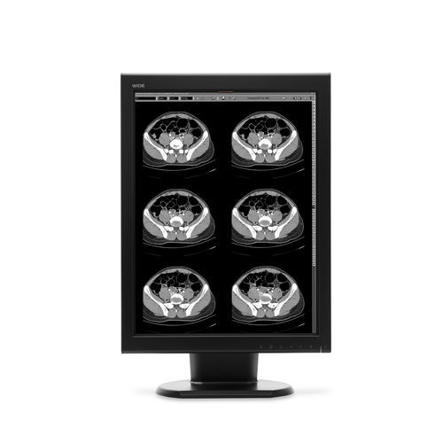 Diagnose-Monitor - MX20N - Wide USA Corporation - für medizinische Bildgebung / 21,3" / LCD