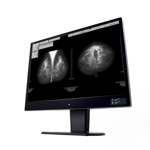 Diagnose-Monitor - CW120N - Wide USA Corporation - für medizinische Bildgebung / 31" / LCD