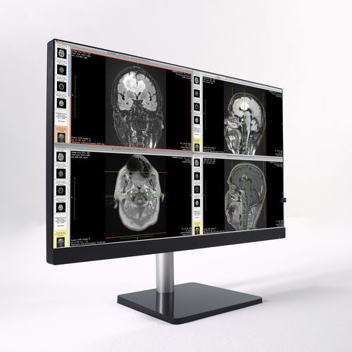 Monitor für medizinische Bildgebung - CL24N - Wide USA Corporation - Full HD / 1920x1200 / 23,8"
