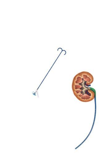 Ureterzugangsschaft - FY series - Hunan Endovascular Device Co., Ltd. - Niere / ausrichtbar / atraumatisch