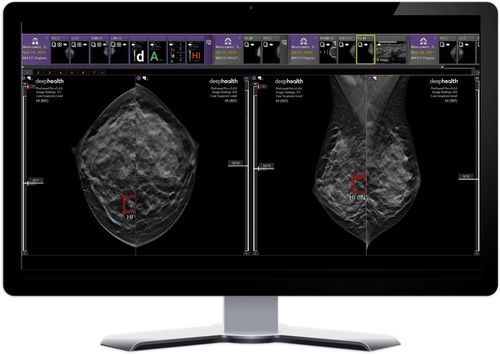 KI-Plattform für Krankenhaus - DeepHealth - für medizinische Bildgebung / für maschinelles Lernen / Viewer