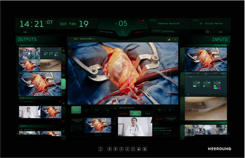 Befestigungselement Integrationssystem - Visor - NOORDUNG DEVA GROUP d.o.o - mit Streaming