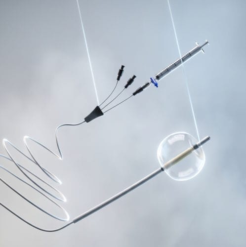 Katheter zur Steinextraktion - Focuz Medical - gastro-enterologisch / Ballon