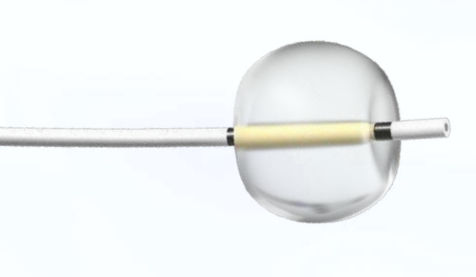 Katheter zur Steinextraktion - Focuz Medical - Gallen / Ballon