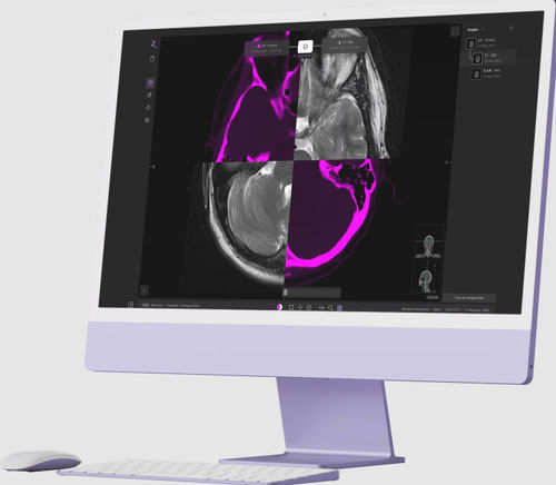 Medizinische Software - zap-axon - ZAP Surgical Systems Inc - Projektentwicklung / Umform / Planung