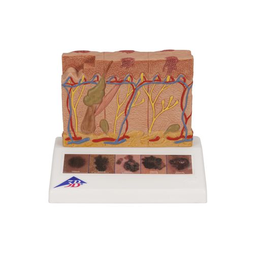 Haut anatomisches Modell - J15 - 3B Scientific   - für die Ausbildung / für Krebserkrankungen